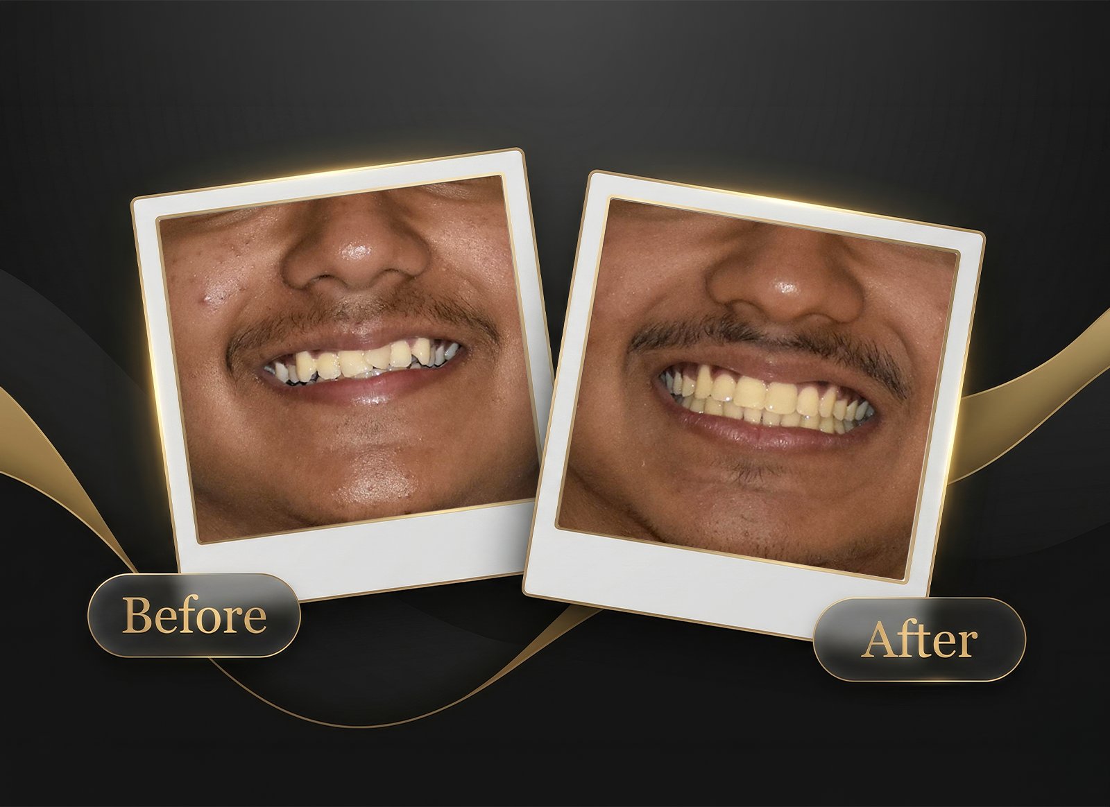 Before & After Case 1